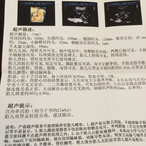 journal_insert_pic_507559224