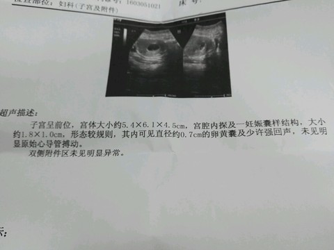 journal_insert_pic_509390053