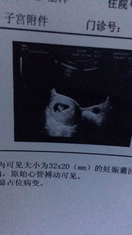 journal_insert_pic_510371927