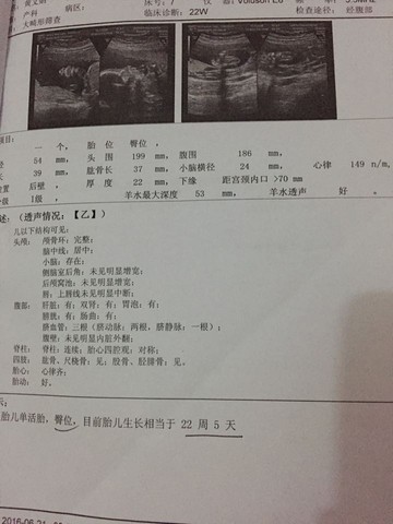 journal_insert_pic_511628134