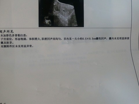 journal_insert_pic_511079111