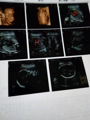 journal_insert_pic_511284703