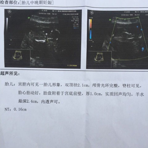 journal_insert_pic_511455187