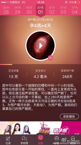 journal_insert_pic_519170977