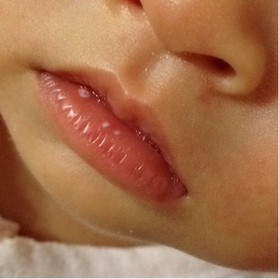 宝宝下嘴唇水泡图片图片