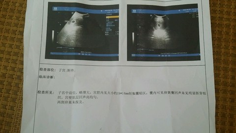 journal_insert_pic_522033308