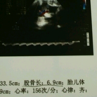 journal_insert_pic_525442485