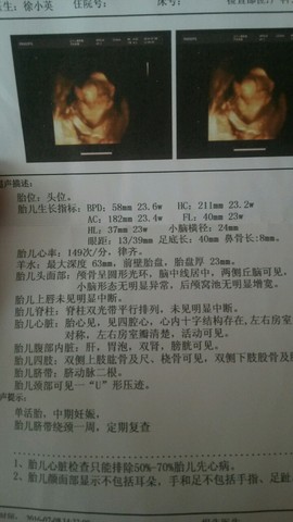 journal_insert_pic_527297209