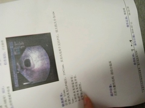 journal_insert_pic_527500217