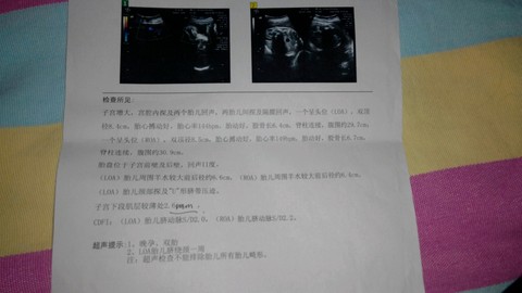 journal_insert_pic_528237958
