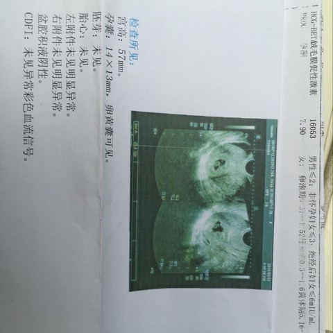 journal_insert_pic_528925184