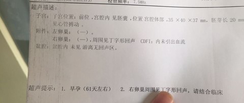 journal_insert_pic_529423238