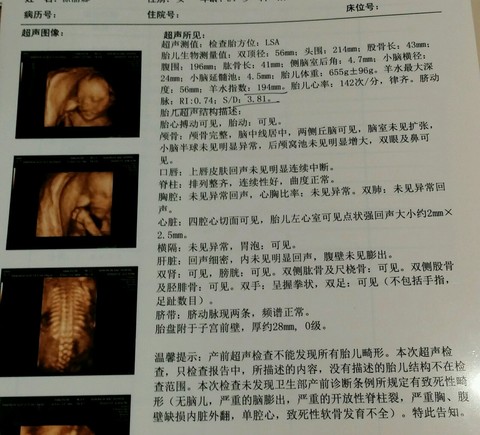 journal_insert_pic_529517551