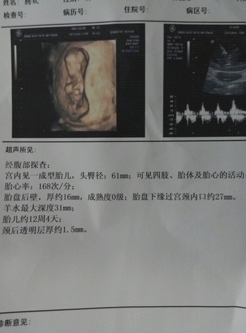 journal_insert_pic_531173966