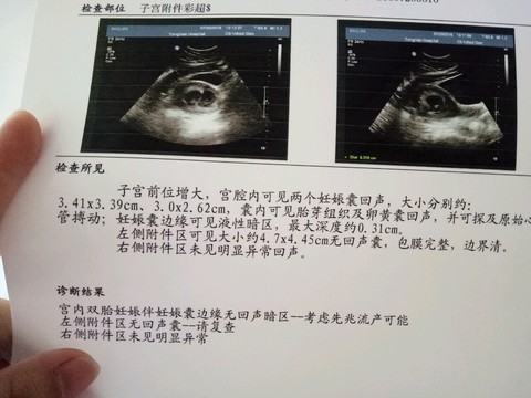 journal_insert_pic_533847220
