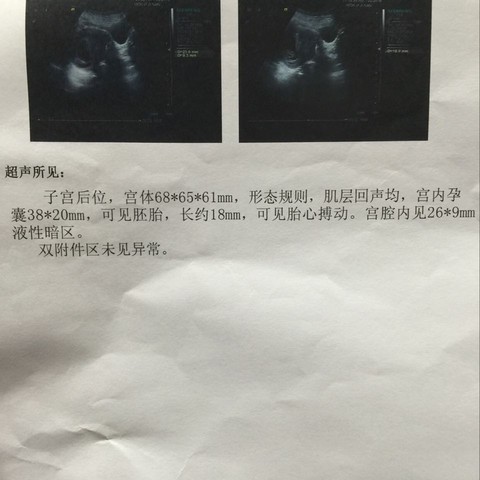 journal_insert_pic_535134350