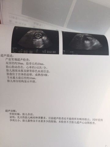 journal_insert_pic_539698026