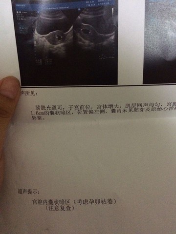 journal_insert_pic_541074361