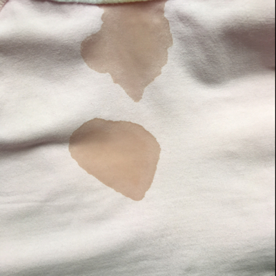 怀孕十四周加四天突然流了像精液味的分泌物是怎麼了?