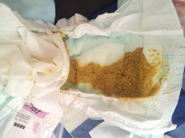 新生儿五天便便成膏状正常吗?