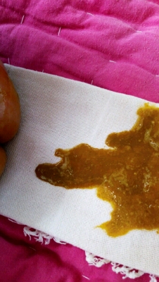 推荐回答                     是不是宝妈吃的太油腻宝宝吃你的母乳