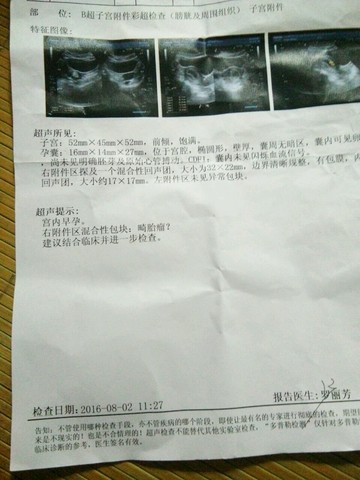 journal_insert_pic_543539221