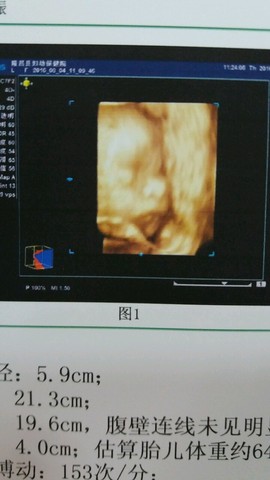 journal_insert_pic_546112148
