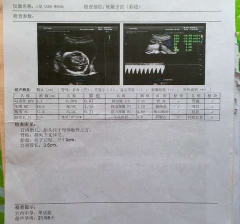 journal_insert_pic_568951435