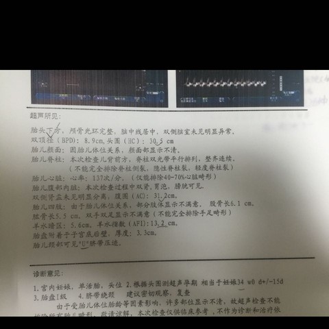journal_insert_pic_587280001