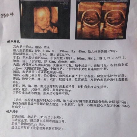 journal_insert_pic_609679332