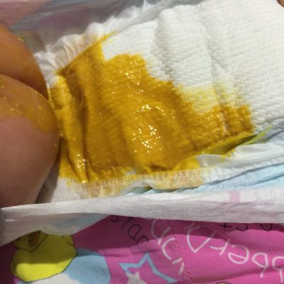 最近两三天开始拉稀.混合喂养宝宝,愁死了.有经验的宝妈帮忙给看看.