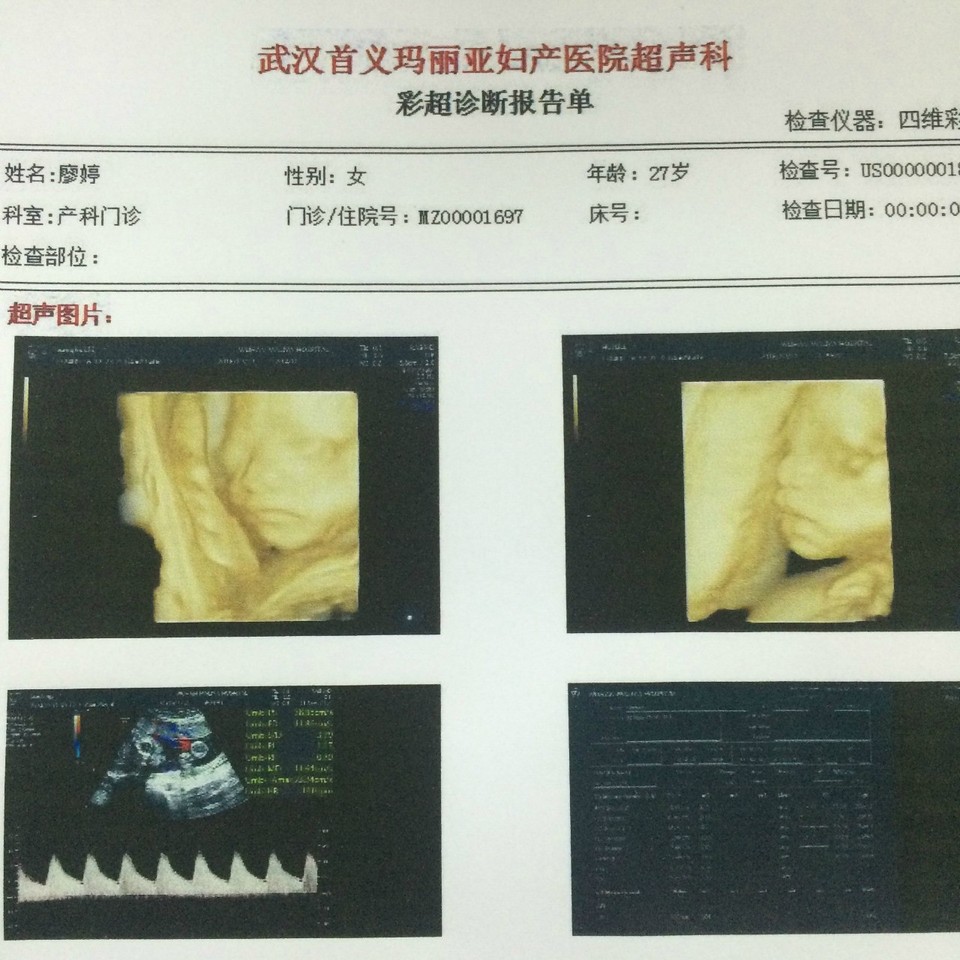 journal_insert_pic_704676942