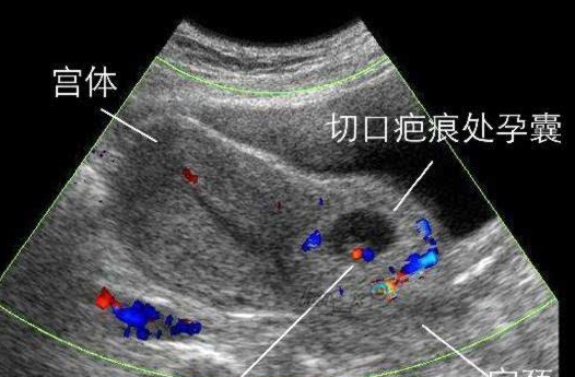 微信截图_20180126131807.png