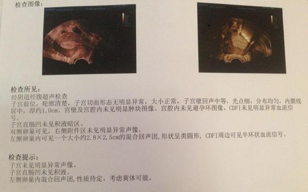 journal_insert_pic_1212537148